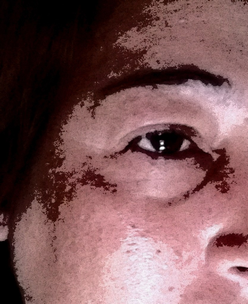 Vítima de violência doméstica.